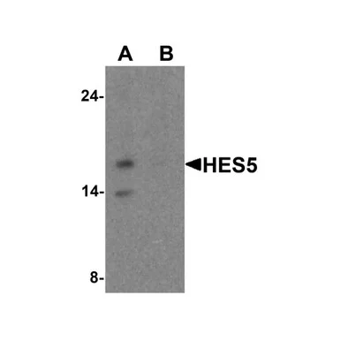 geneseesci20260712121124958253
