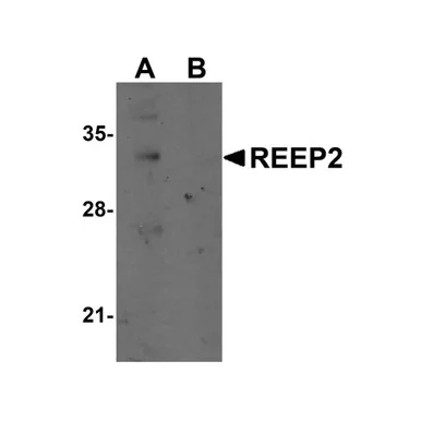 geneseesci20260712143048973359