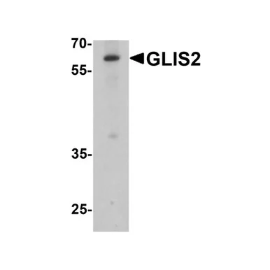 geneseesci20260712175024993016