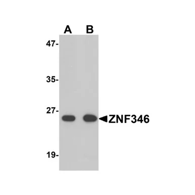 geneseesci20260712184138998231
