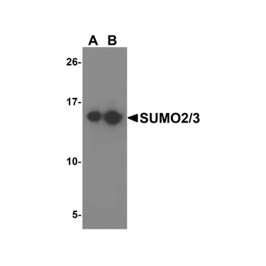 geneseesci202607122001281006555