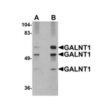 geneseesci202607122042001011085